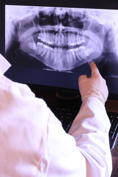 Best Walk-In Emergency Dentist in Rancho Mission Viejo, CA